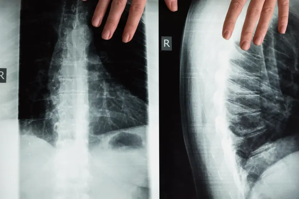 A veterinarian reviewing a dog&#x27;s joint imaging on a lightbox